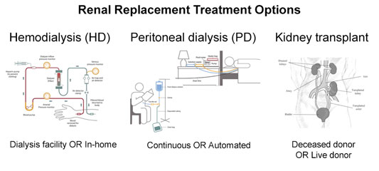 chart showing three different renal replacement treatment options